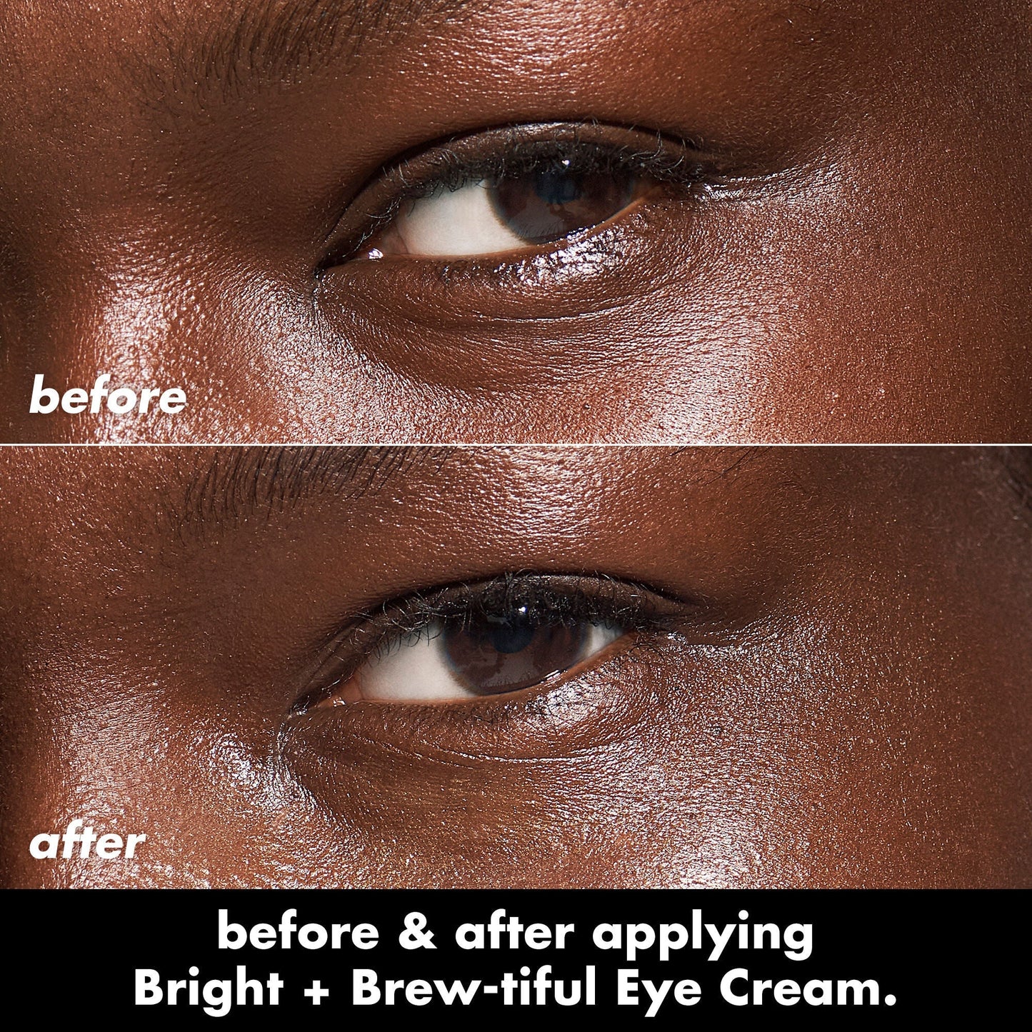 bright-brew-tiful-eye-cream-u0 0226_BBEC_Eye_BA_Diptych_607e3ec2-f0e1-4365-9b28-17574d841250.jpg