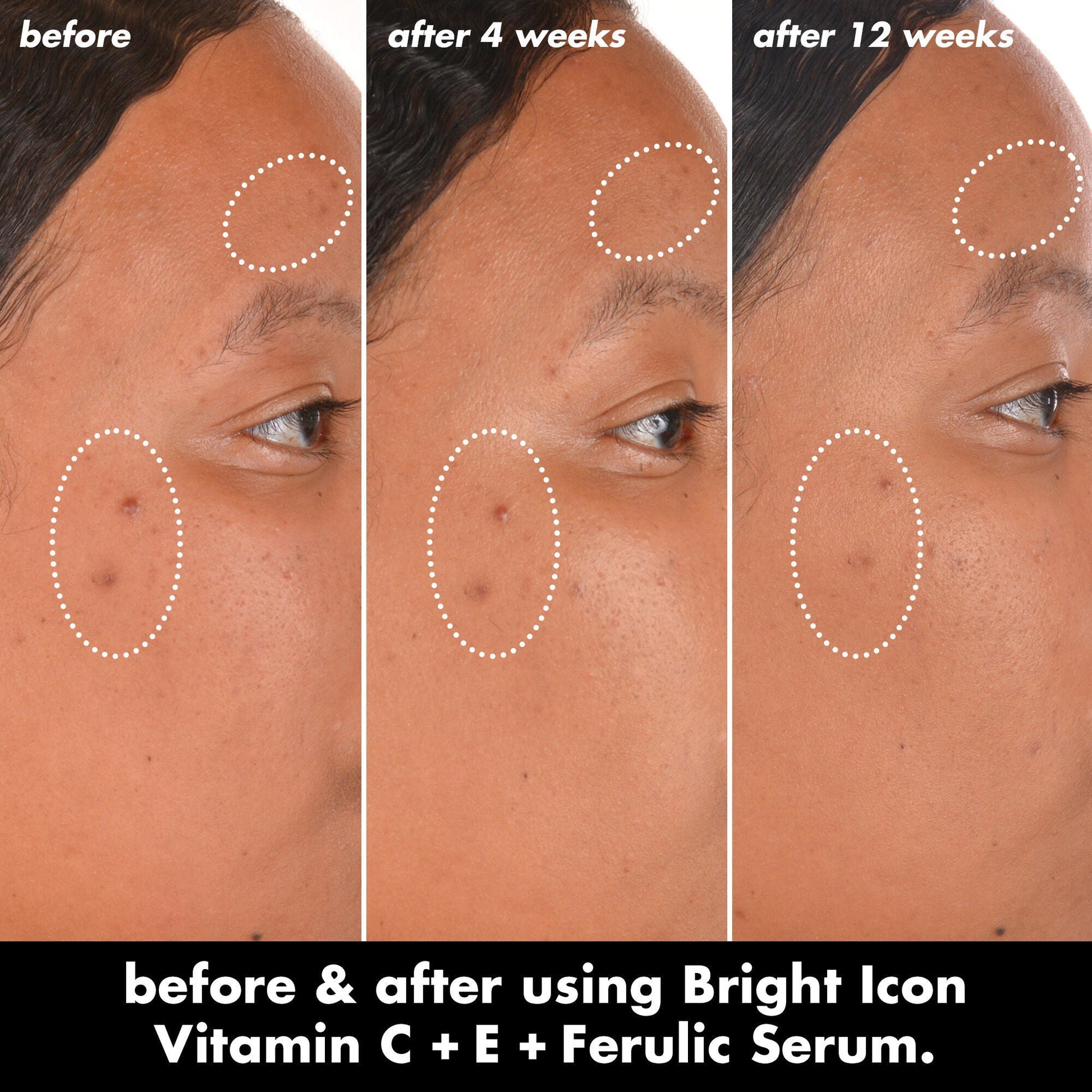 bright-icon-vitamin-c-e-ferulic-serum-u8 0226_EDU_BrightIconVitC_BA_Chanel_TRIPTYCH_c58f2fc8-209d-414f-9ba3-666a07a94887.jpg