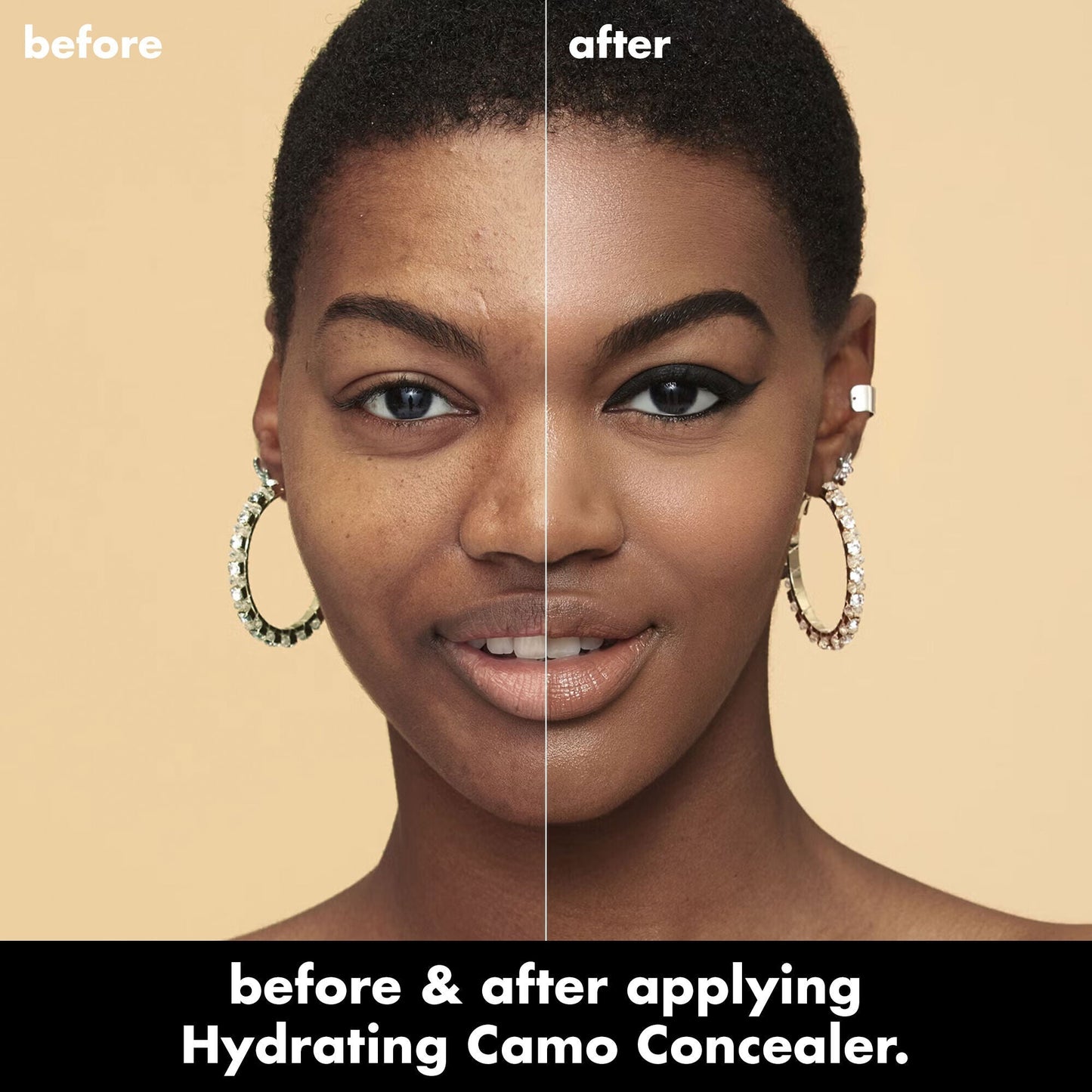 hydrating-camo-concealer-q9 0226_EDU_HydratingCamoConcelaer_BA_AshleyKaresh_20_1_d8499bbf-0e91-4173-b5e2-75127caf83a3.jpg