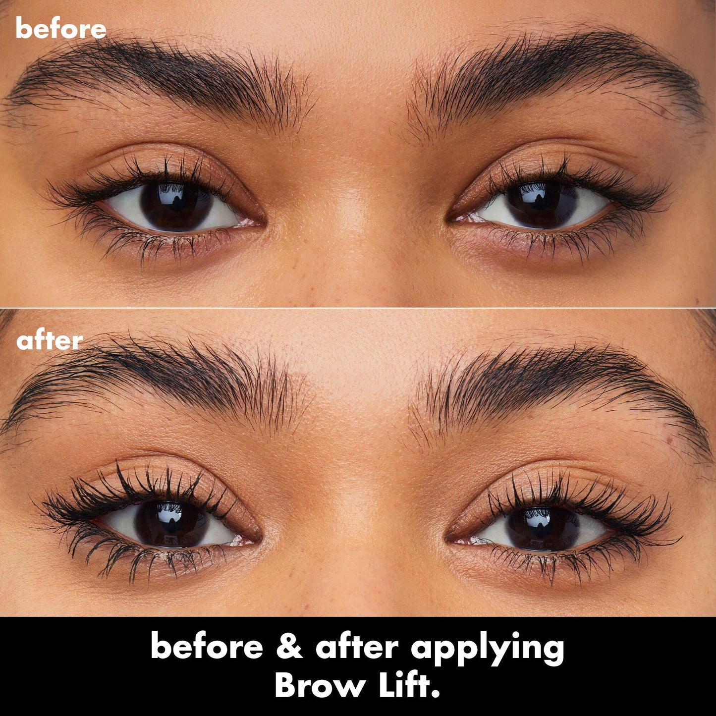 brow-lift-m8 0326_EDU_BrowLift_BA.jpg