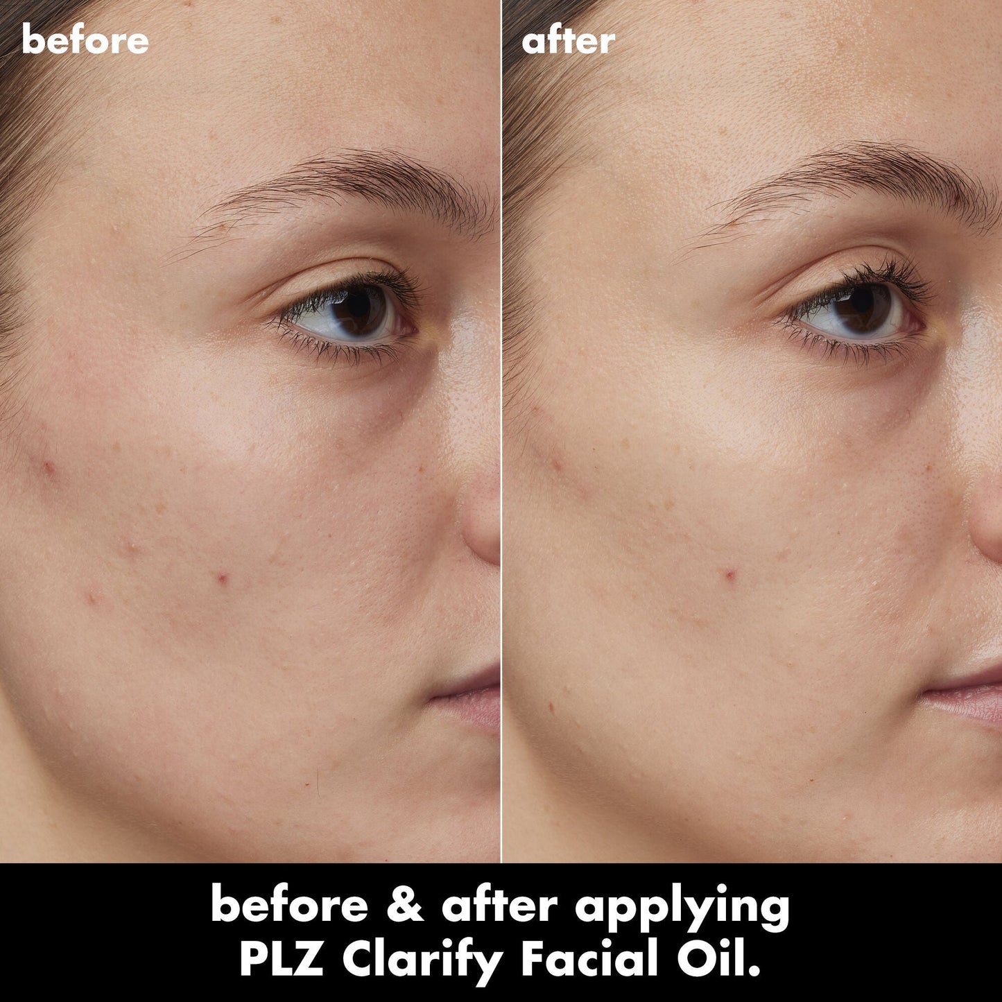 plz-clarify-facial-oil-e0 0326_EDU_PlzClarify_BA_Kelly.jpg