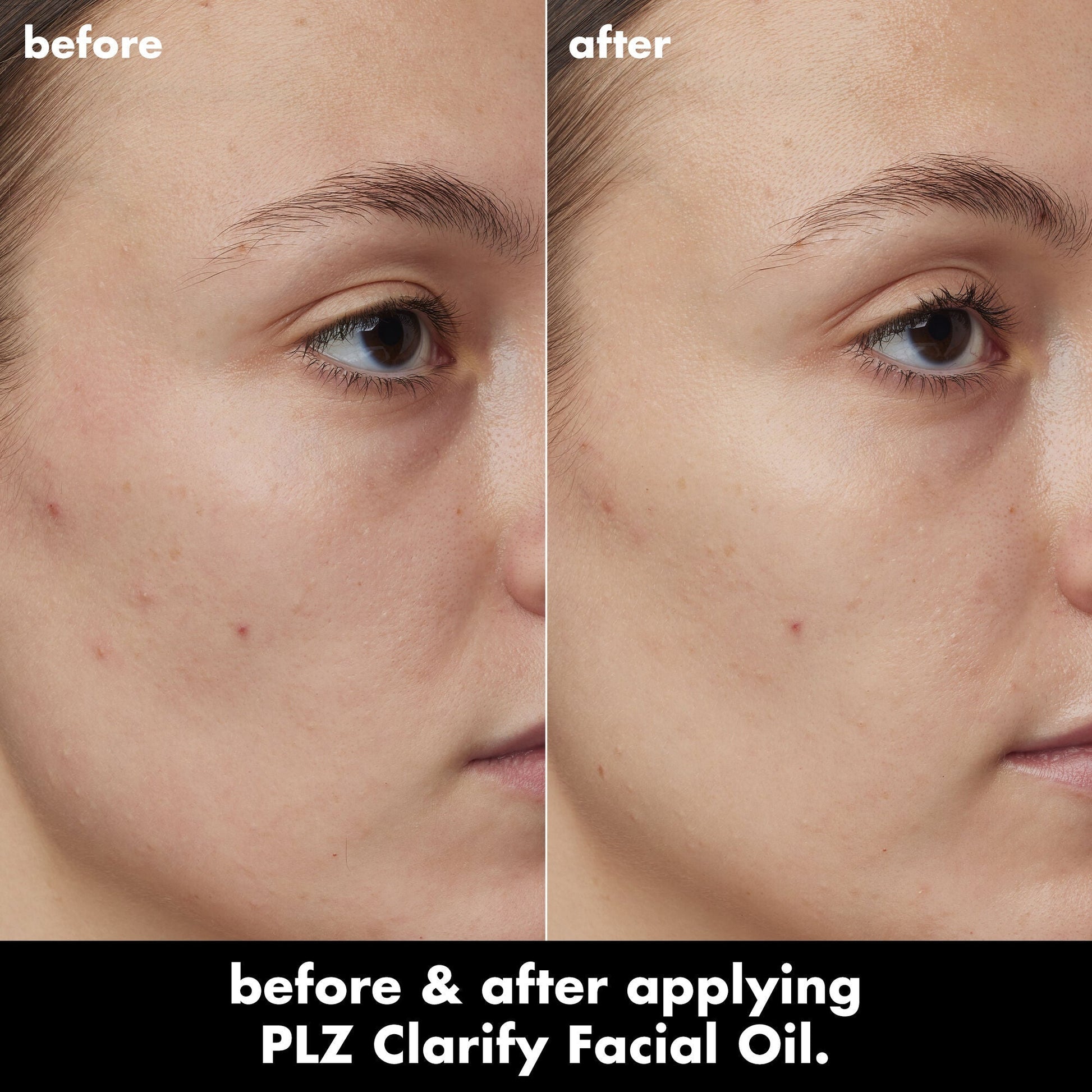 plz-clarify-facial-oil-e0 0326_EDU_PlzClarify_BA_Kelly.jpg