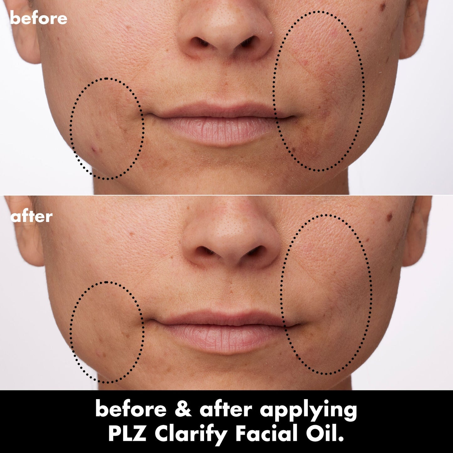 plz-clarify-facial-oil-e0 0326_EDU_PlzClarify_BA_Paula.jpg