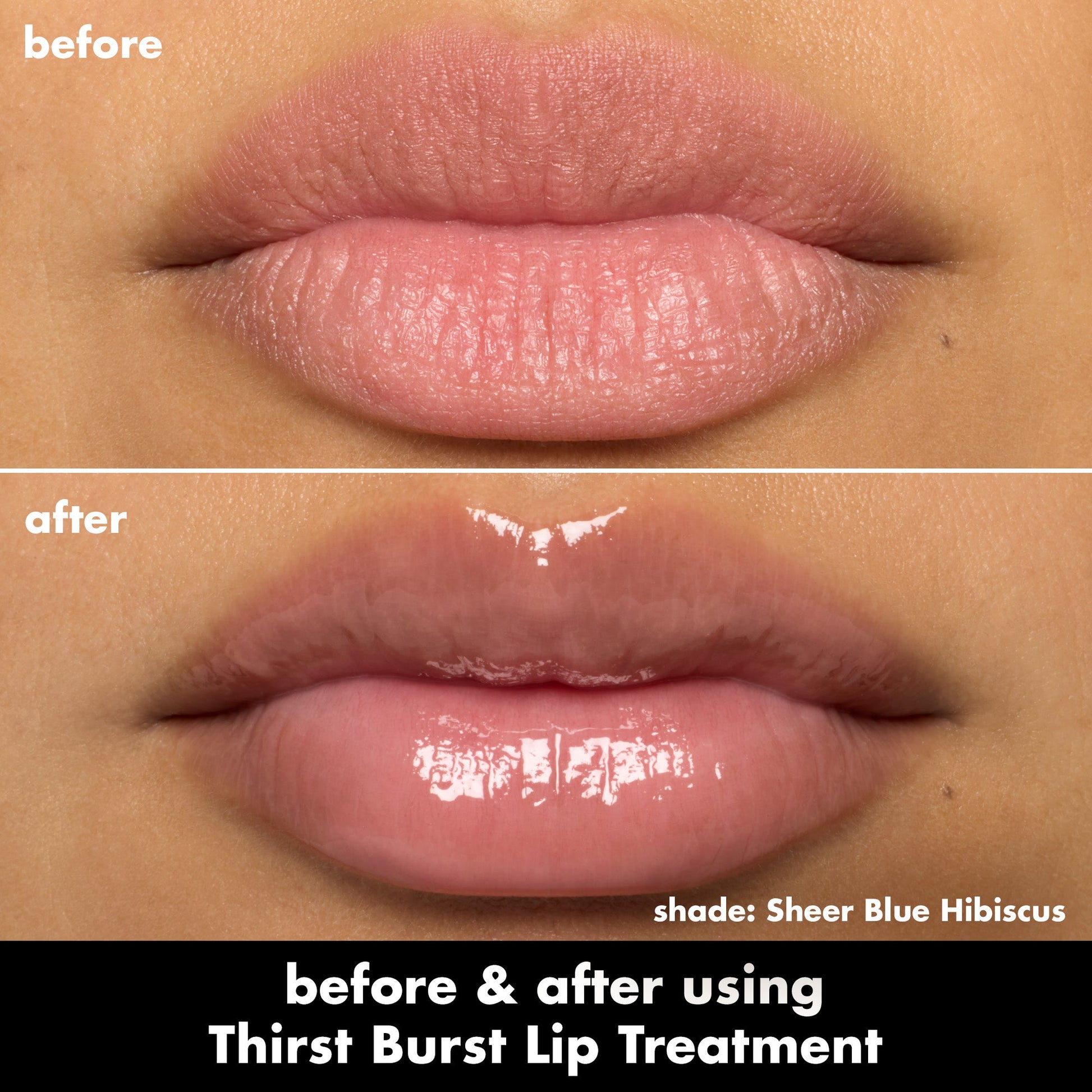 thirst-burst-lip-treatment-k1 0526_SEO_ThirstBurstLipTreatment_BA_SheerBlueHibiscus.jpg