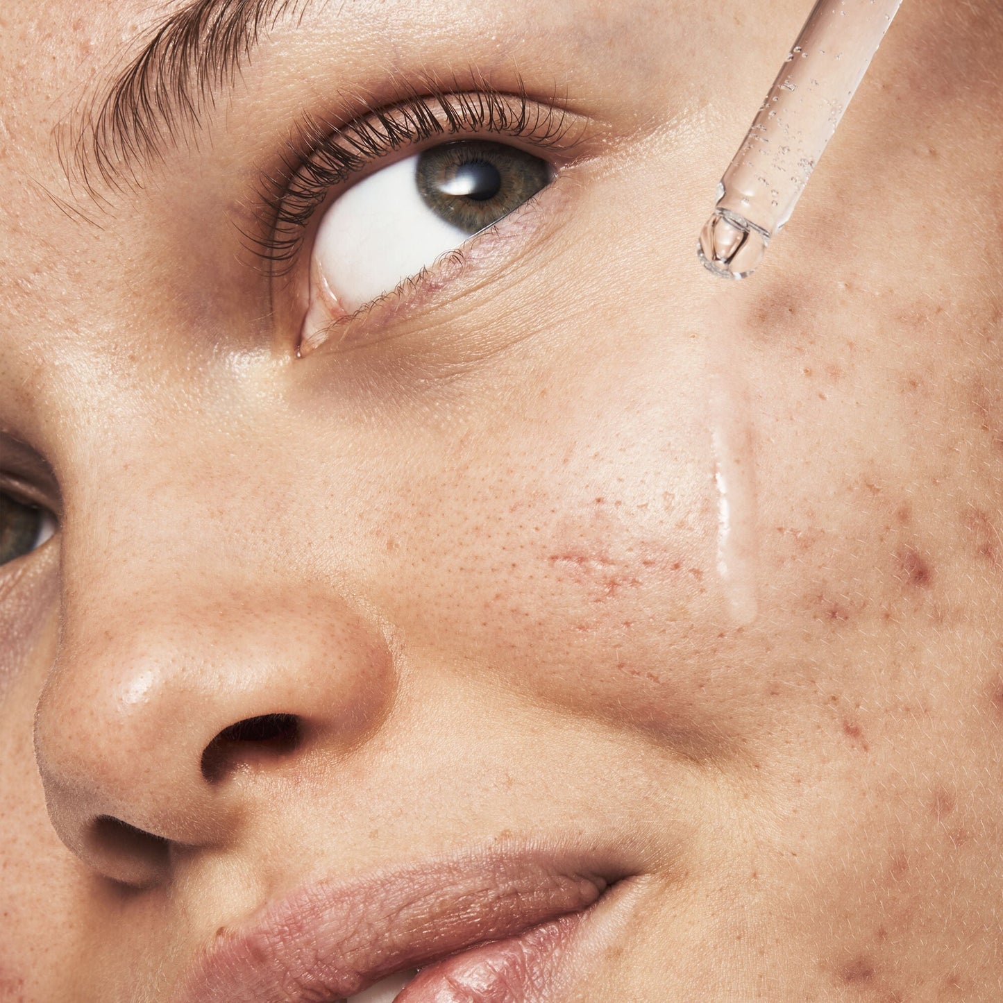 blemish-breakthrough-triple-acid-resurfacing-serum-j5 121321_Marley-Acne-Regimen_0254_FINAL_IGF.jpg