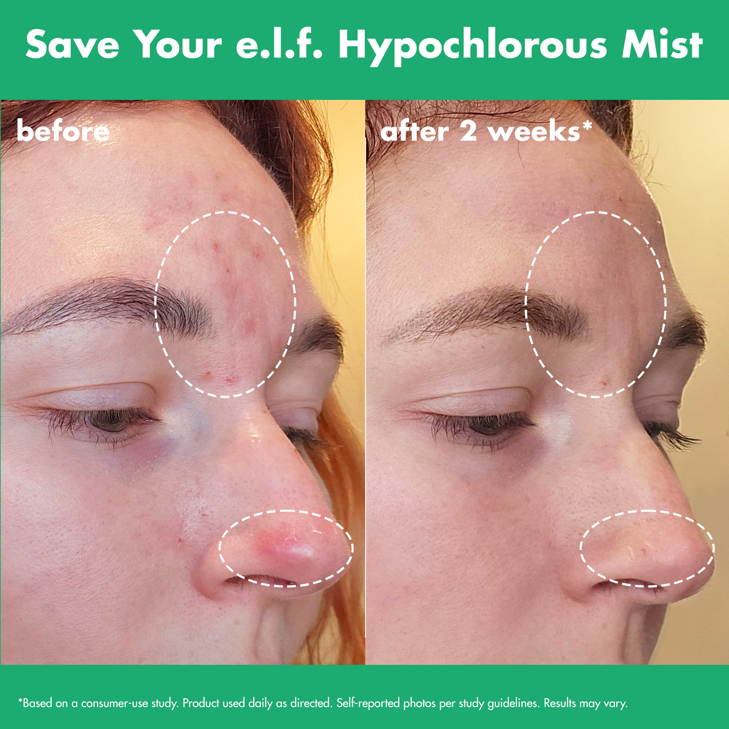 save-your-e-l-f-hypochlorous-mist-b7 FA26_EDUCATION_SAVEYOURELF_USAGE_BA1_WITHOUT_CLAIMS.png