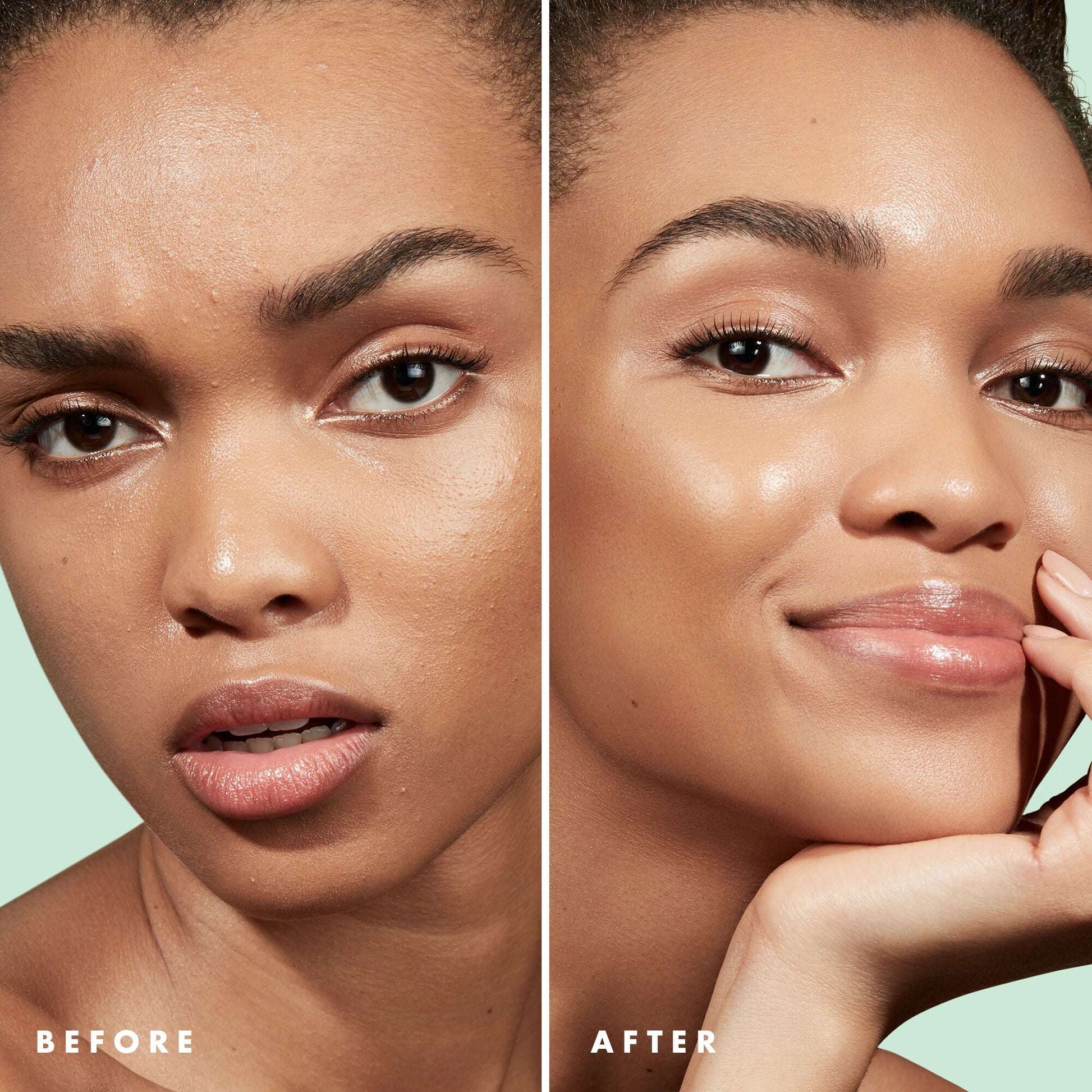 blemish-control-face-primer-large-size-j9 Primer_PP_Before_After_BlemishControl_2000x2000_3774231e-d4e1-49dd-b3d7-a73cbac901fe.jpg