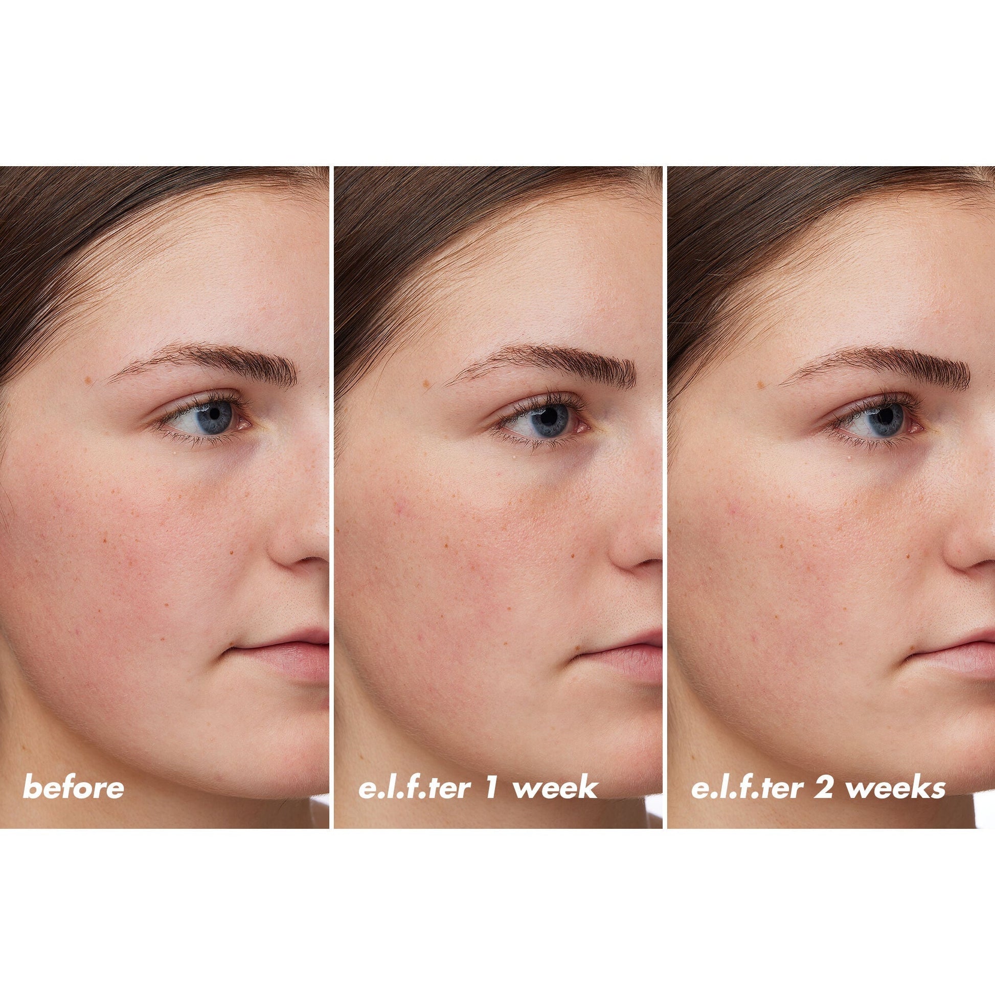 holy-hydration-barrier-goals-cream-regular-j0 XX26_EDUCATION_HH-BarrierGoals_B_A_Zoe_TRYPTICH_74c905bd-67bd-4b91-b633-2b01a8905cb8.jpg